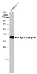 Anti-Synaptophysin antibody [GT2589] used in Western Blot (WB). GTX633972