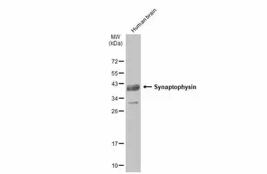 Anti-Synaptophysin antibody [GT2589] used in Western Blot (WB). GTX633972