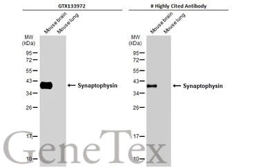 Anti-Synaptophysin antibody [GT2589] used in Western Blot (WB). GTX633972