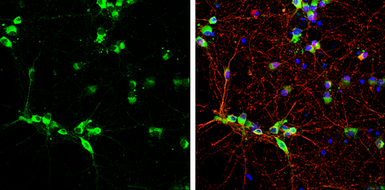 Anti-Syntenin 1 antibody [GT1523] used in Immunocytochemistry/ Immunofluorescence (ICC/IF). GTX634154
