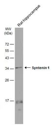 Anti-Syntenin 1 antibody [GT1523] used in Western Blot (WB). GTX634154