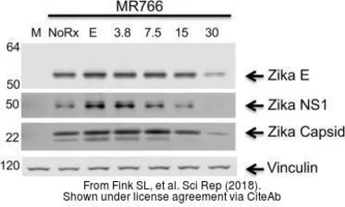 Anti-Zika virus NS1 protein antibody [GT281] used in Western Blot (WB). GTX634159