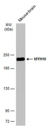 Anti-MYH10 antibody [GT246] used in Western Blot (WB). GTX634160