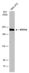 Anti-MYH10 antibody [GT246] used in Western Blot (WB). GTX634160