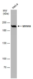 Anti-MYH10 antibody [GT246] used in Western Blot (WB). GTX634160
