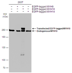 Anti-MYH10 antibody [GT246] used in Western Blot (WB). GTX634160