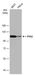 Anti-PYK2 antibody [GT858] used in Western Blot (WB). GTX634162