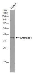 Anti-Arginase 1 antibody [GT5811] used in Western Blot (WB). GTX634218