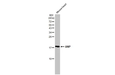 Anti-ANP antibody [GT1068] used in Western Blot (WB). GTX634219