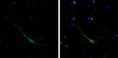 Anti-NF-H antibody [GT114] used in Immunocytochemistry/ Immunofluorescence (ICC/IF). GTX634289