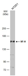 Anti-NF-H antibody [GT114] used in Western Blot (WB). GTX634289