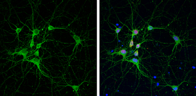 Anti-PSD95 antibody [GT1234] used in Immunocytochemistry/ Immunofluorescence (ICC/IF). GTX634291