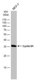 Anti-Cyclin D1 antibody [GT8912] used in Western Blot (WB). GTX634347