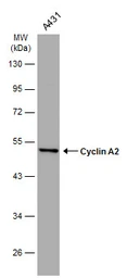 Anti-Cyclin A2 antibody [GT2547] used in Western Blot (WB). GTX634420