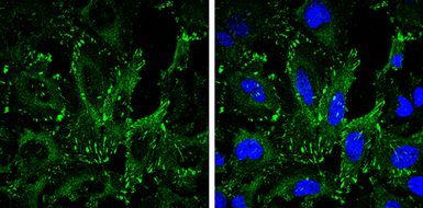 Anti-VASP antibody [GT238] used in Immunocytochemistry/ Immunofluorescence (ICC/IF). GTX634448