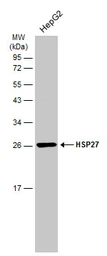 Anti-HSP27 antibody [GT6310] used in Western Blot (WB). GTX634459