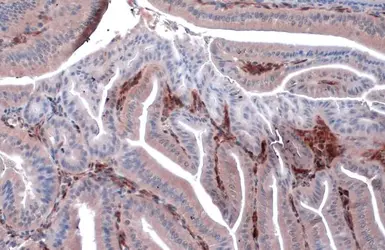 Anti-HSP27 antibody [GT6310] used in IHC (Paraffin sections) (IHC-P). GTX634459