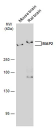 Anti-MAP2 antibody [GT378] used in Western Blot (WB). GTX634471