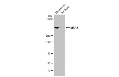 Anti-MAP2 antibody [GT925] used in Western Blot (WB). GTX634473
