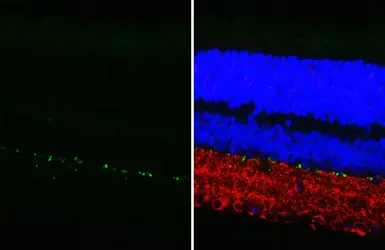 Anti-Tyrosine Hydroxylase antibody [GT234] used in IHC (Paraffin sections) (IHC-P). GTX634481