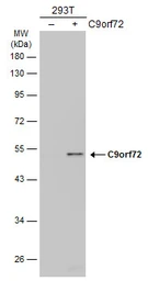 Anti-C9orf72 antibody [GT1553] used in Western Blot (WB). GTX634482