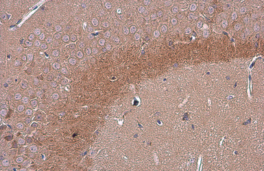 Anti-C9orf72 antibody [GT1553] used in IHC (Paraffin sections) (IHC-P). GTX634482
