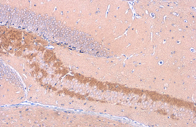 Anti-C9orf72 antibody [GT1553] used in IHC (Paraffin sections) (IHC-P). GTX634482