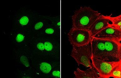 Anti-Rb antibody [2B5] used in Immunocytochemistry/ Immunofluorescence (ICC/IF). GTX634627