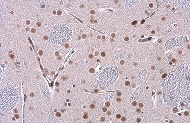 Anti-Glucocorticoid Receptor antibody [GT248] used in IHC (Paraffin sections) (IHC-P). GTX634647