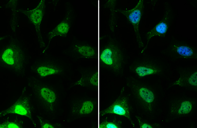 Anti-EED antibody [GT885] used in Immunocytochemistry/ Immunofluorescence (ICC/IF). GTX634650