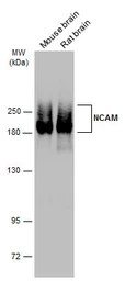 Anti-NCAM antibody [GT135] used in Western Blot (WB). GTX634792