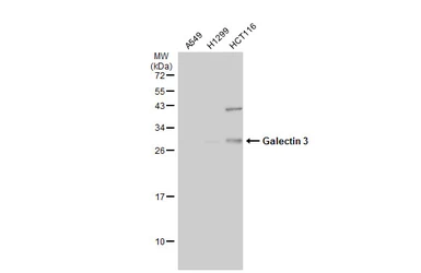 Anti-Galectin 3 antibody [GT1188] used in Western Blot (WB). GTX635156