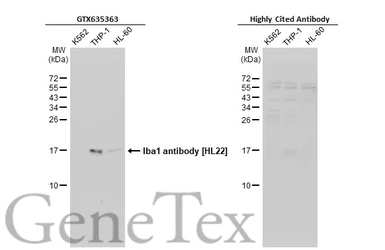 Anti-Iba1 antibody [HL22] used in Western Blot (WB). GTX635363