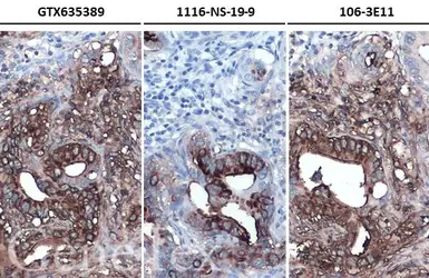 Anti-CA19-9 antibody [GT933] used in IHC (Paraffin sections) (IHC-P). GTX635389