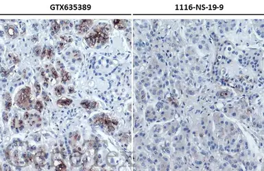 Anti-CA19-9 antibody [GT933] used in IHC (Paraffin sections) (IHC-P). GTX635389