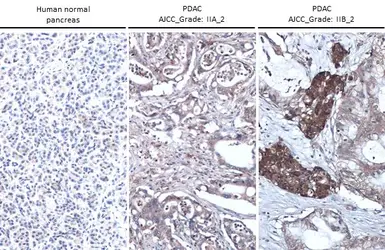 Anti-Thrombospondin 2 antibody [GT147] used in IHC (Paraffin sections) (IHC-P). GTX635393