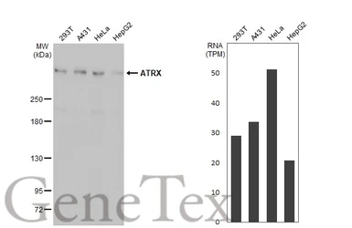 Anti-ATRX antibody [HL1210] used in Western Blot (WB). GTX635478