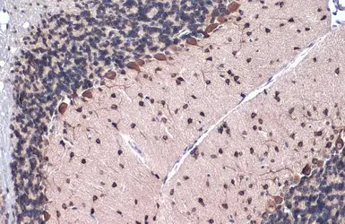 Anti-Gli1 antibody [HL247] used in IHC (Paraffin sections) (IHC-P). GTX635619