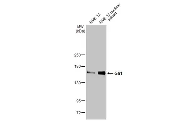 Anti-Gli1 antibody [HL247] used in Western Blot (WB). GTX635619