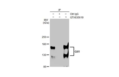 Anti-Gli1 antibody [HL247] used in Immunoprecipitation (IP). GTX635619