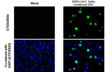 Anti-SARS-CoV-2 (COVID-19) Spike S1 antibody [HL6] used in IHC-P (cell pellet) (IHC-P (cell pellet)). GTX635654