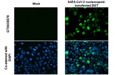 Anti-SARS-CoV-2 (COVID-19) Nucleocapsid antibody [HL249] used in Immunocytochemistry/ Immunofluorescence (ICC/IF). GTX635678