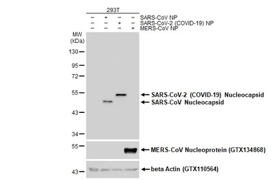 Anti-SARS-CoV-2 (COVID-19) Nucleocapsid antibody [HL249] used in Western Blot (WB). GTX635678