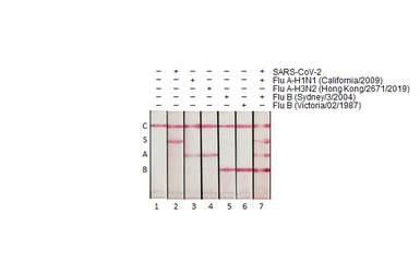 Anti-SARS-CoV-2 (COVID-19) Nucleocapsid antibody [HL448] used in Lateral Flow (Lateral Flow). GTX635686