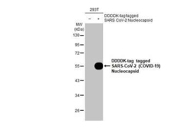 Anti-SARS-CoV-2 (COVID-19) Nucleocapsid antibody [HL5511] used in Western Blot (WB). GTX635689