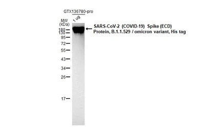 Anti-SARS-CoV-2 (COVID-19) Spike RBD antibody [HL257] used in Western Blot (WB). GTX635692