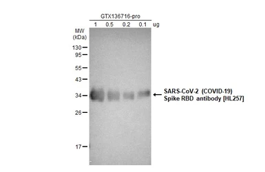 Anti-SARS-CoV-2 (COVID-19) Spike RBD antibody [HL257] used in Western Blot (WB). GTX635692