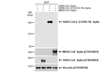 Anti-SARS-CoV-2 (COVID-19) Spike S1 antibody [HL13402] used in Western Blot (WB). GTX635713