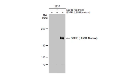 Anti-EGFR (L858R Mutant) antibody [HL1022] used in Western Blot (WB). GTX635834