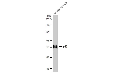 Anti-p63 antibody [HL1027] used in Western Blot (WB). GTX635841